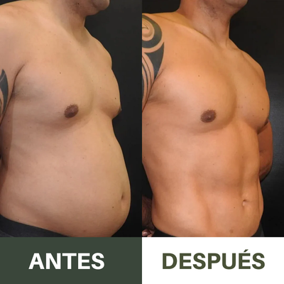 Kit Antiparasitario de Aceite de Ricino Nuvira™