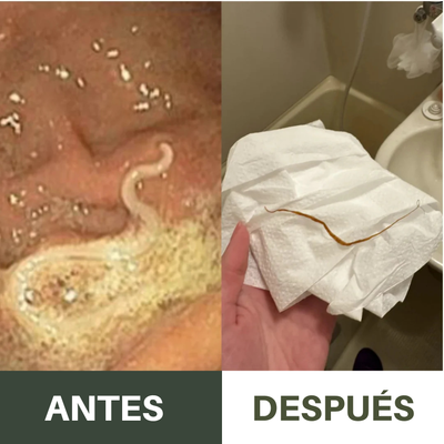 Kit Antiparasitario de Aceite de Ricino Nuvira™