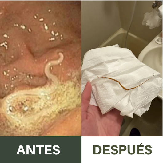 Kit Antiparasitario de Aceite de Ricino Nuvira™