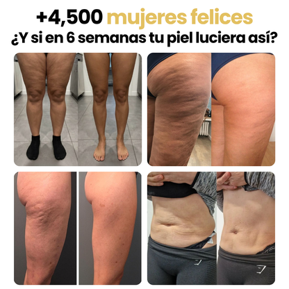Nuvira™ Gel Criotérmico Anticelulitis (Adiós Celulitis y Estrías en 12 Días)